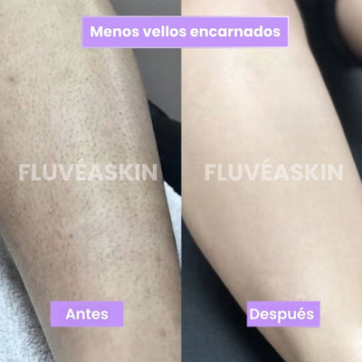 FluvéaSkin® - Vello más fino y menos visible con Raiz de Cyperus Rotundus