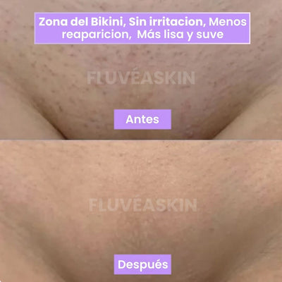 FluvéaSkin® - Vello más fino y menos visible con Raiz de Cyperus Rotundus