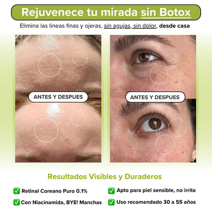 Retinal Fluvéa® - Elimina Arrugas y Rejuvenece sin Botox en 14 Días