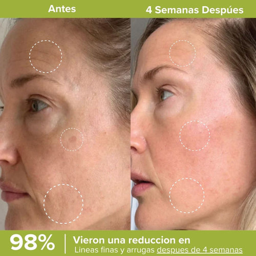 Retinal Fluvéa® - Elimina Arrugas y Rejuvenece sin Botox en 14 Días