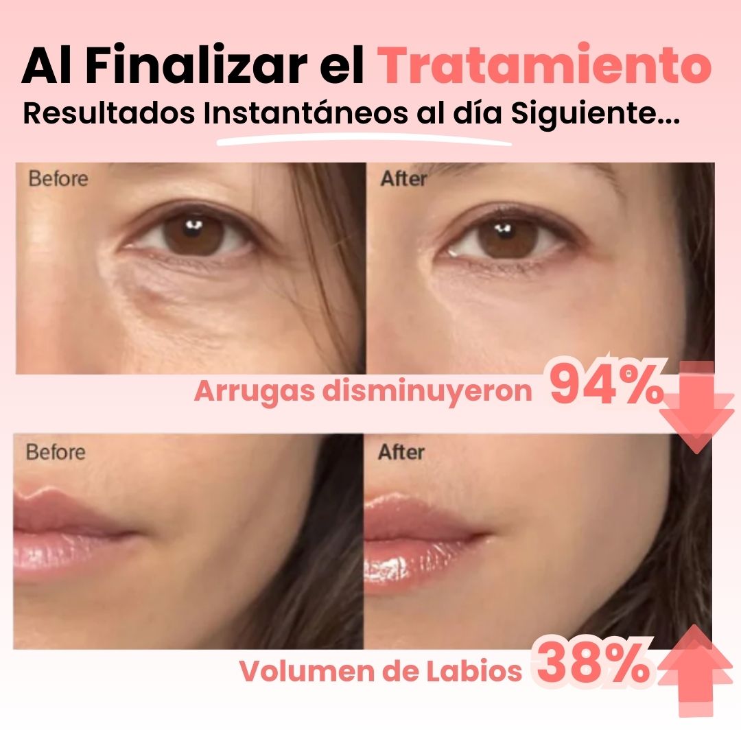 FluvéaGlow® - Serúm de Colágeno Coreano con infusión de Volufiline