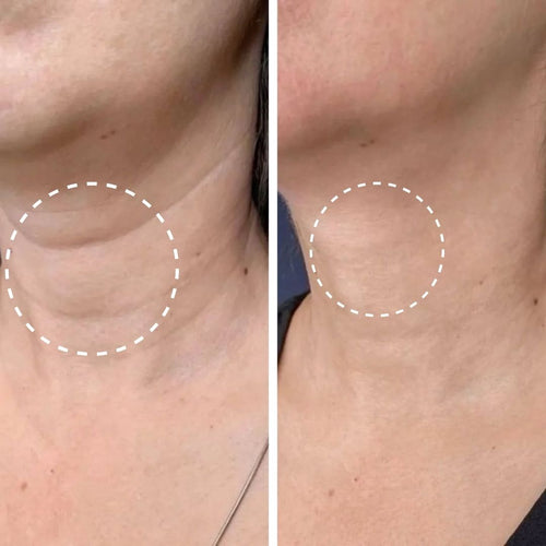 Retinal Fluvéa® - Elimina Arrugas y Rejuvenece sin Botox en 14 Días