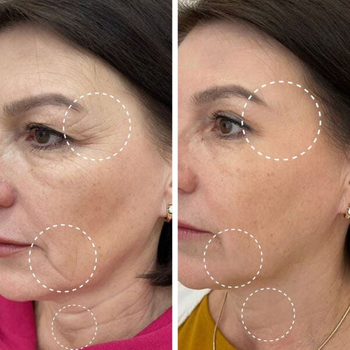 Retinal Fluvéa® - Elimina Arrugas y Rejuvenece sin Botox en 14 Días